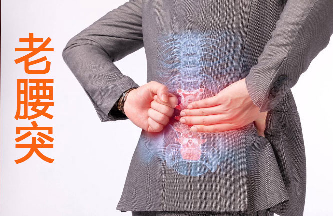 治老腰突用鐵腰板 治老腰突用鐵腰板