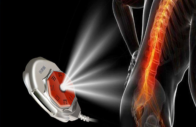 鐵腰板是腰椎間盤突出最好的治療方法 鐵腰板是腰椎間盤突出最好的治療方法