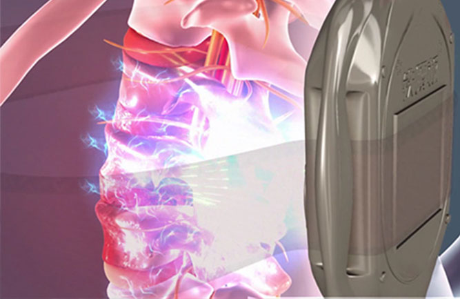 治療腰椎間盤突出最好的方法是什么 治療腰椎間盤突出最好的方法是什么